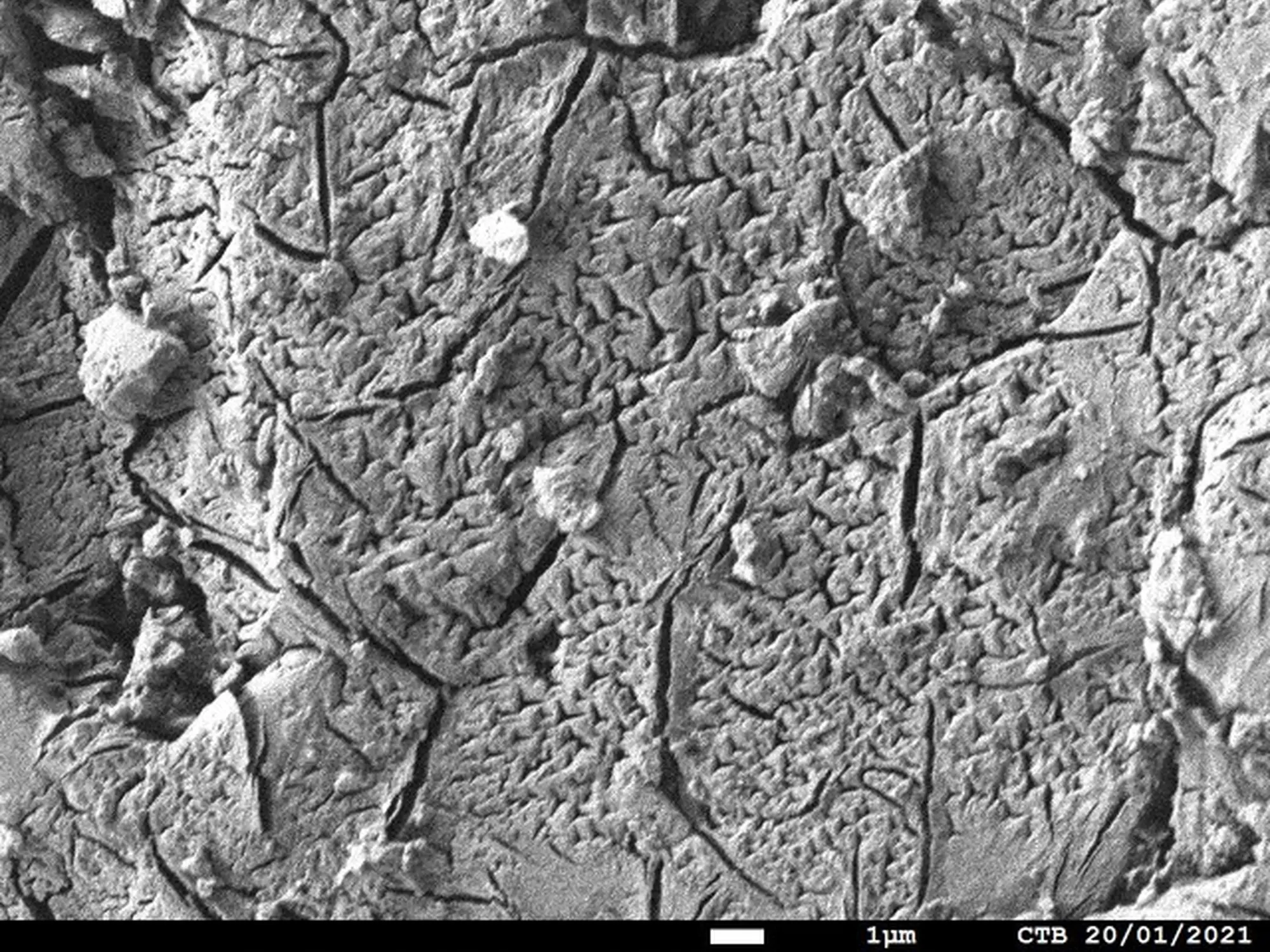 struvite sem