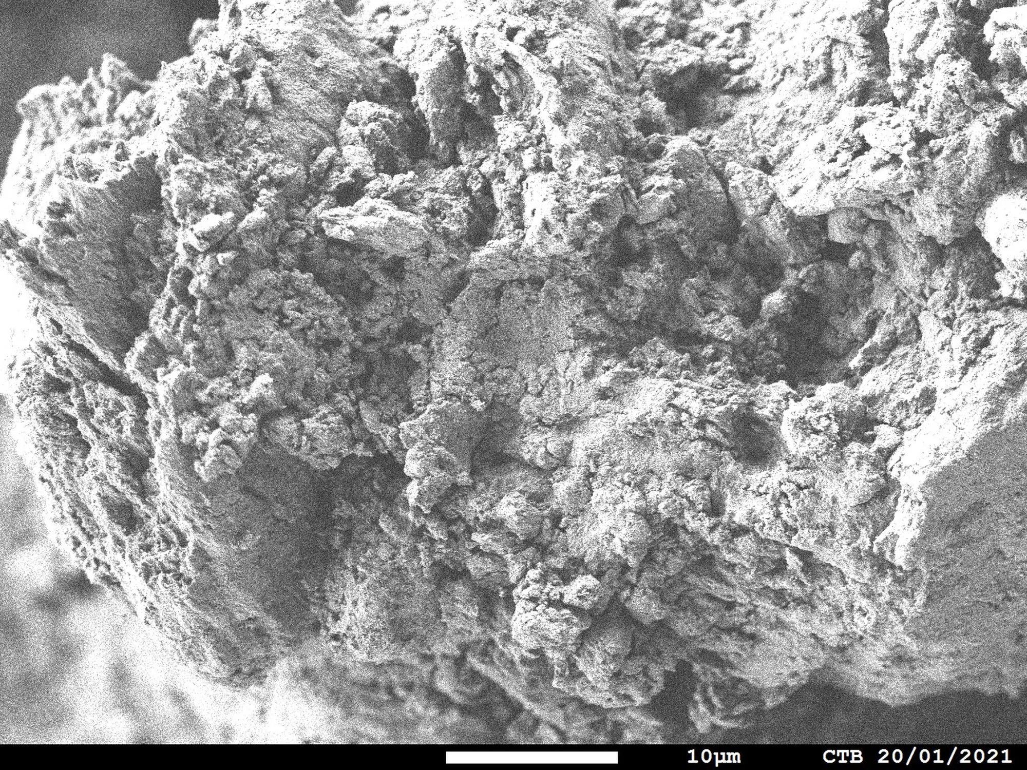 SEM hydroxyapatite